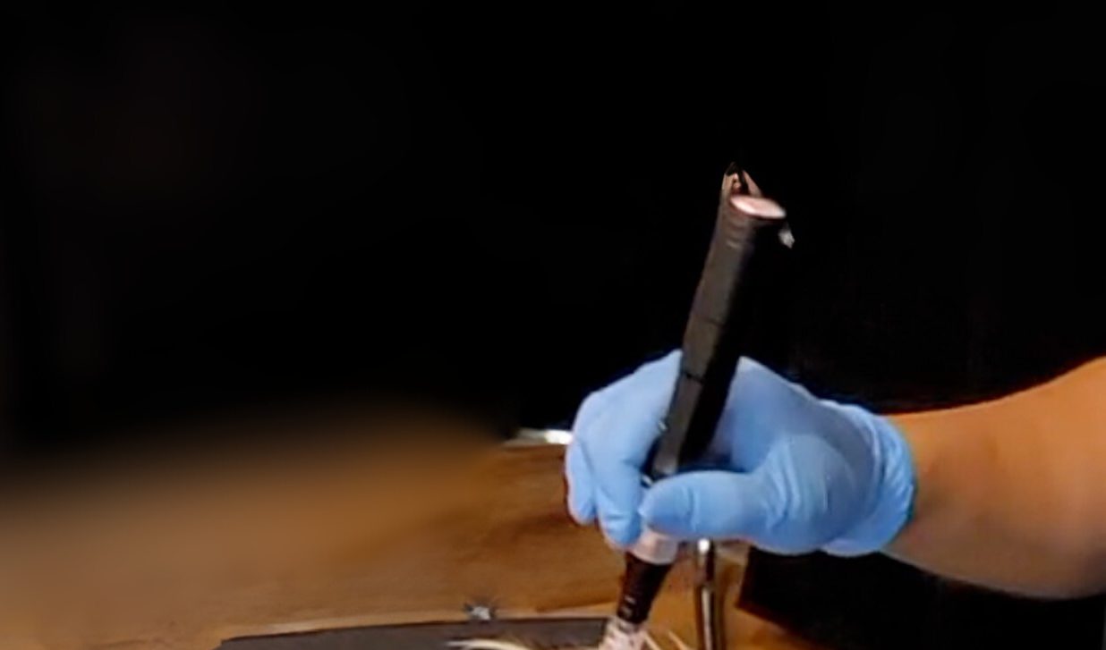 A hand in a blue nitrile glove holding a pen-style microneedling device upright in a dim treatment room